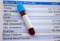 Click to see image detail cholesteraltest.jpg